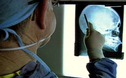 Autopsie - Mysteriöse Todesfälle