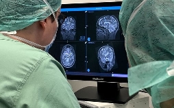 Gehirn unter Strom - Hilfe bei Depression, Epilepsie und Parkinson?