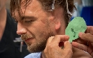 Verpfuscht - Die Beauty Docs on Tour | TV-Programm von sixx