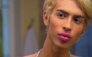 Verpfuscht - Ein Fall für die Beauty Docs | TV-Programm von sixx