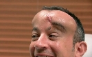 Botched | TV-Programm von sixx