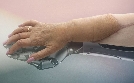 Die neue Hand - Geschichte einer Transplantation | TV-Programm von arte