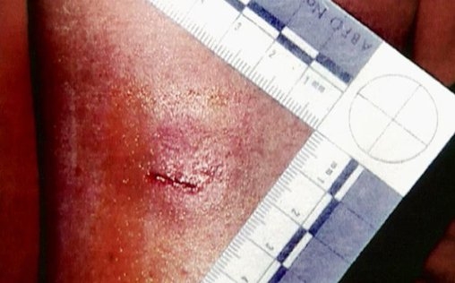 Medical Detectives - Geheimnisse der Gerichtsmedizin 
 A Clutch of Witnesses