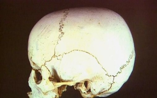 Medical Detectives - Geheimnisse der Gerichtsmedizin 
 Spur für Spur